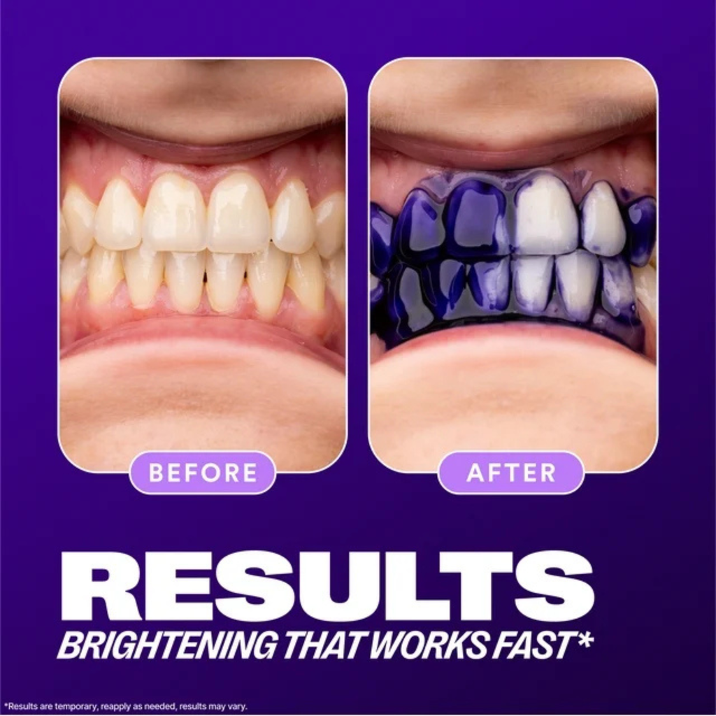 Hismile V34 Colour Corrector Serum – Advanced Teeth Whitening Purple Toner – Instant Colour Correcting Formula for Brighter, Whiter Smile – Enamel-Safe Tooth Brightening Booster for Daily Use