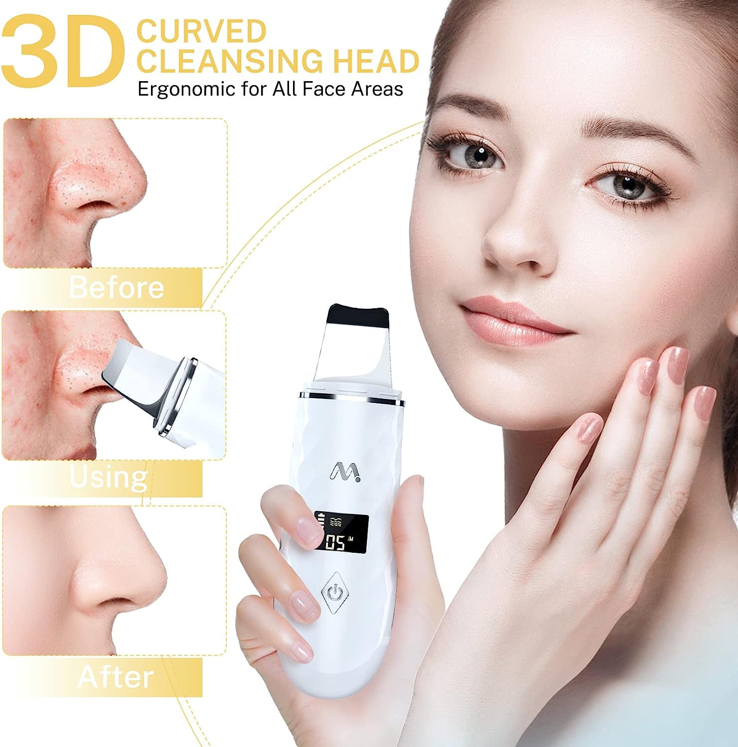 Misiki Facial Scrubber Spatula 4 Functional Modes Blackhead Remover for Facial Skin Cleaning USB Rechargeable